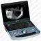 Mindray MX8 Exp Аппарат УЗИ фото 1
