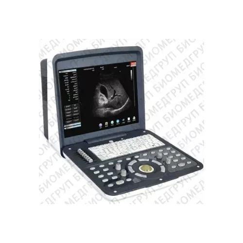 Acuvista RS880d 15" Аппарат УЗИ фото 1