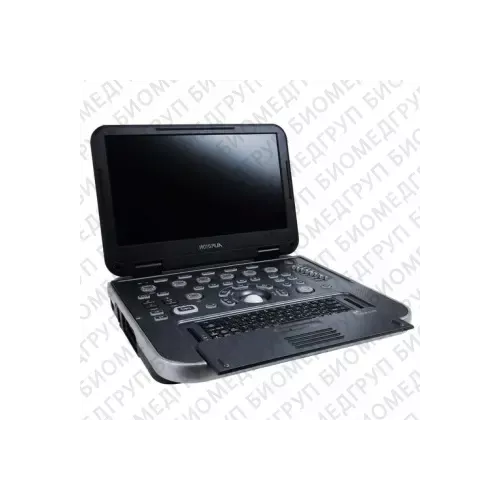 Alpinion E-cube i7 Аппарат УЗИ фото 1