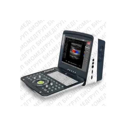Acuvista RS880i Аппарат УЗИ фото 1